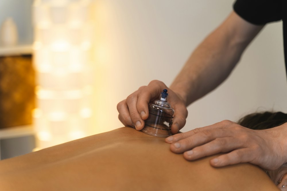 Cupping therapy demonstration