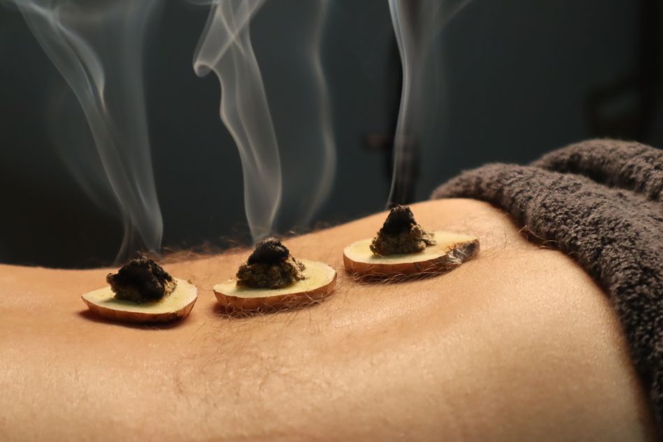 Moxa material burning during a traditional moxibustion demonstration